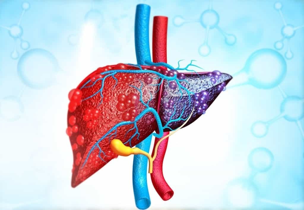 What is Cirrhosis of The Liver Cause, Treatment, Symptoms